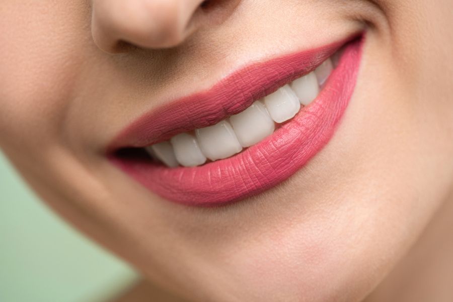 Sonrisa de una paciente